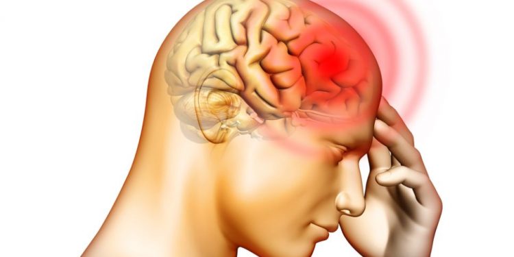 אורן זריף עזר לי עם כאבי הראש ואני מרגישה הרבה יותר טוב – Oren Zarif