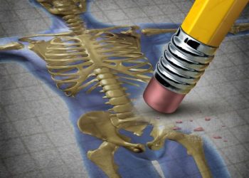 אורן זריף העלים לי את הכאבים ביריכיים – Oren Zarif