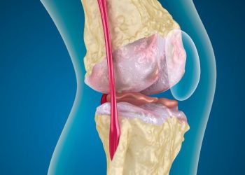 סבלתי מבעיה בברך – הטיפול של אורן זריף עזר לי מאוד – Oren Zarif