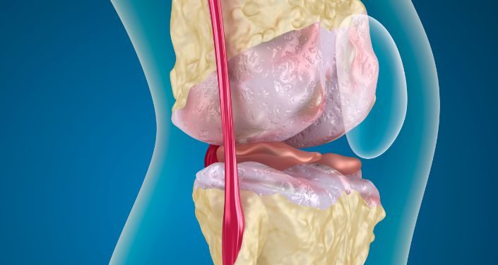 סבלתי מבעיה בברך – הטיפול של אורן זריף עזר לי מאוד – Oren Zarif