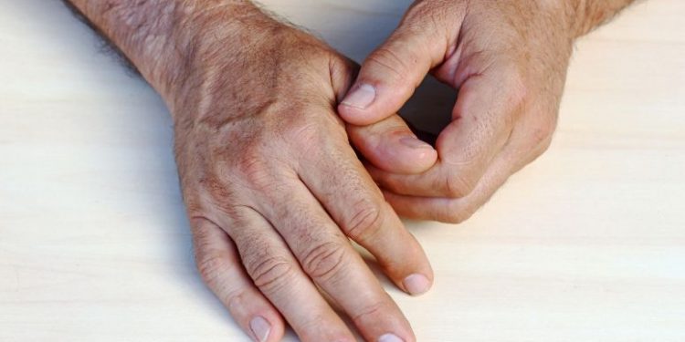 אורן זריף העלים לי את הכאבים ביד, ואני מתפקדת כרגיל – Oren Zarif