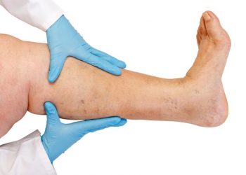 הרופאים לא הצליחו לטפל, אורן זריף הציל אותי מכריתת רגל – Oren Zarif