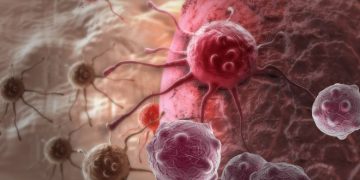 סבלתי מגידול ברחם – הטיפול של אורן זריף עזר לי מאוד – Oren Zarif