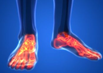 הרופאים לא עזרו לי, אורן זריף העלים לי את כאבי הרגליים. – Oren Zarif