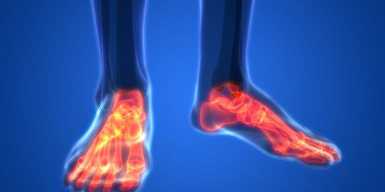 הרופאים לא עזרו לי, אורן זריף העלים לי את כאבי הרגליים. – Oren Zarif