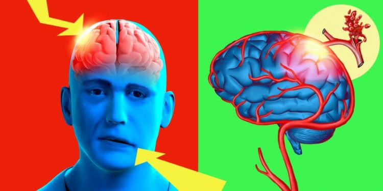 סבלתי משיתוק בפנים – הטיפול של אורן זריף עזר לי מאוד – Oren Zarif