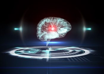 שבץ מוחי אורן זריף טיפול שכדאי להכיר – Oren Zarif