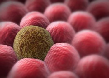 סבלתי מציסטה בשחלה – הטיפול של אורן זריף עזר לי מאוד – Oren Zarif