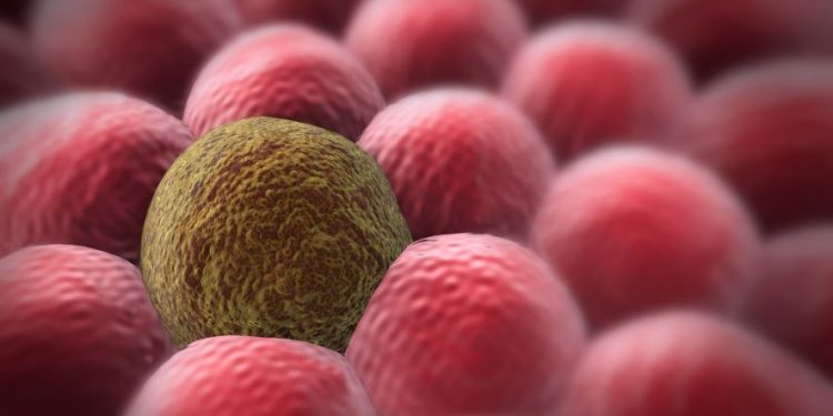 סבלתי מציסטה בשחלה – הטיפול של אורן זריף עזר לי מאוד – Oren Zarif