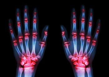 אורן זריף החזיר לי את התחושה בידיים – Oren Zarif