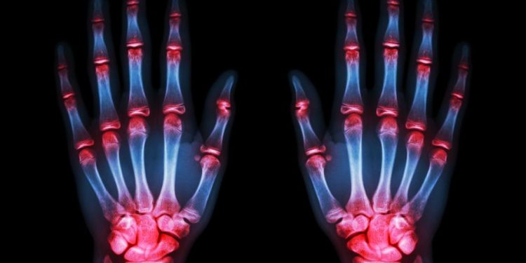 אורן זריף החזיר לי את התחושה בידיים – Oren Zarif