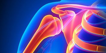 סבלתי מקרע בכתף – הטיפול של אורן זריף עזר לי מאוד – Oren Zarif