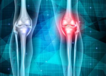 סבלתי מבעיה ברגליים – הטיפול של אורן זריף עזר לי מאוד – Oren Zarif