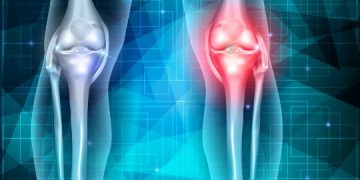 סבלתי מבעיה ברגליים – הטיפול של אורן זריף עזר לי מאוד – Oren Zarif