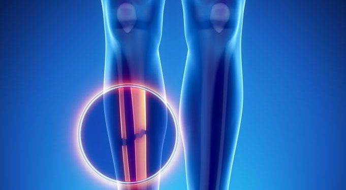 אורן זריף עזר לאמא שלי להעלים את כאבי הרגלים לאחר שנים ללא הצלחה – Oren Zarif