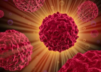 סבלתי מגושים סרטניים בכבד – הטיפול של אורן זריף עזר לי מאוד – Oren Zarif