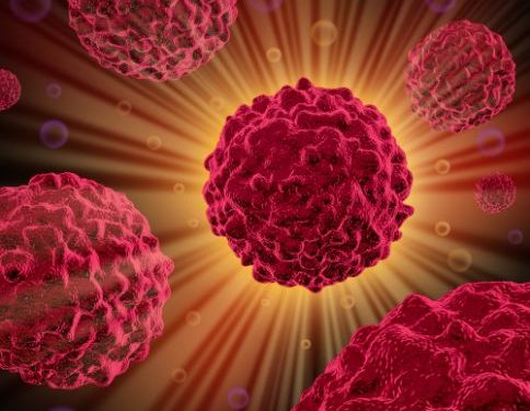 סבלתי מגושים סרטניים בכבד – הטיפול של אורן זריף עזר לי מאוד – Oren Zarif