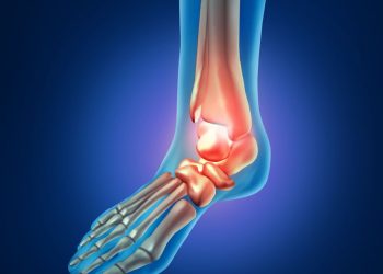 אורן זריף העלים לי את הדלקת ברגל! – Oren Zarif