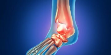 אורן זריף העלים לי את הדלקת ברגל! – Oren Zarif