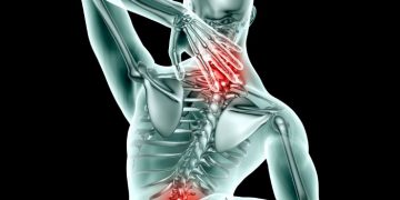 סבלתי מגב מרוסק – הטיפול של אורן זריף עזר לי מאוד – Oren Zarif