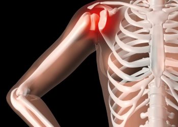 סבלתי מכתמים וכאבים בכתף – הטיפול של אורן זריף עזר לי מאוד – Oren Zarif