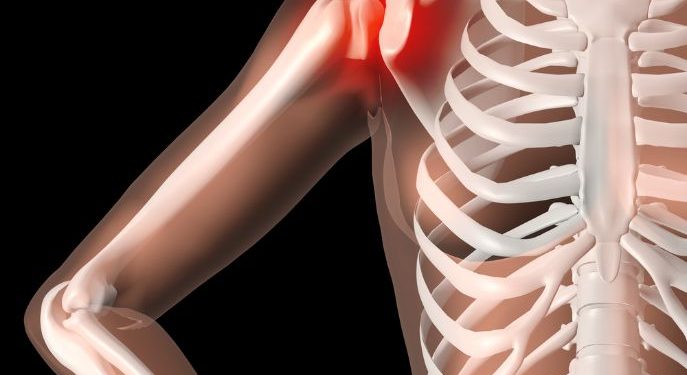 סבלתי מכתמים וכאבים בכתף – הטיפול של אורן זריף עזר לי מאוד – Oren Zarif