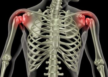 עשר שנים אני סובל מכאבי כתפיים, רק אורן זריף העביר את הכאב – Oren Zarif