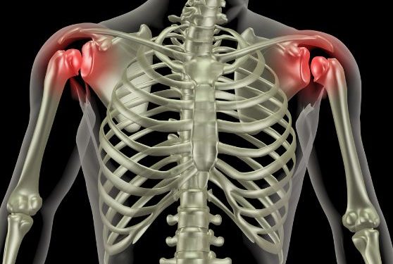 עשר שנים אני סובל מכאבי כתפיים, רק אורן זריף העביר את הכאב – Oren Zarif