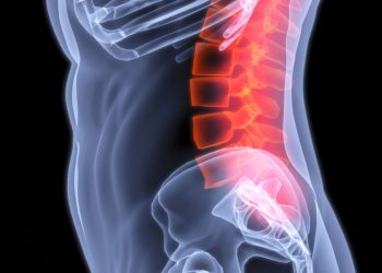 אנשים רבים ושונים חווים סוגים שונים של כאבי גב – אורן זריף – כאבי גב – Oren Zarif