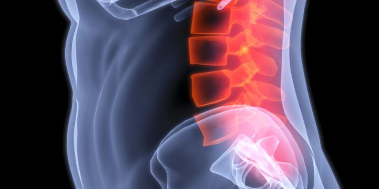 אנשים רבים ושונים חווים סוגים שונים של כאבי גב – אורן זריף – כאבי גב – Oren Zarif