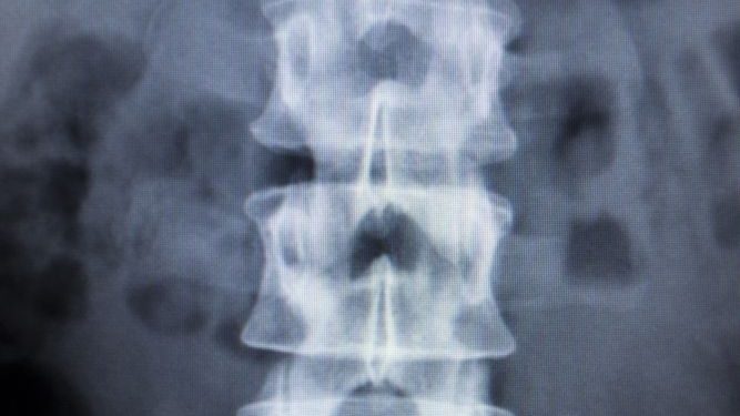 אנשים רבים ושונים חווים סוגים שונים של כאבי גב – אורן זריף – כאבי גב – Oren Zarif