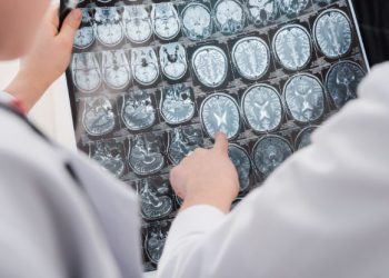 הצעד הראשון למניעת שבץ מוחי הוא תזונה בריאה – אורן זריף – אירוע מוחי – Oren Zarif