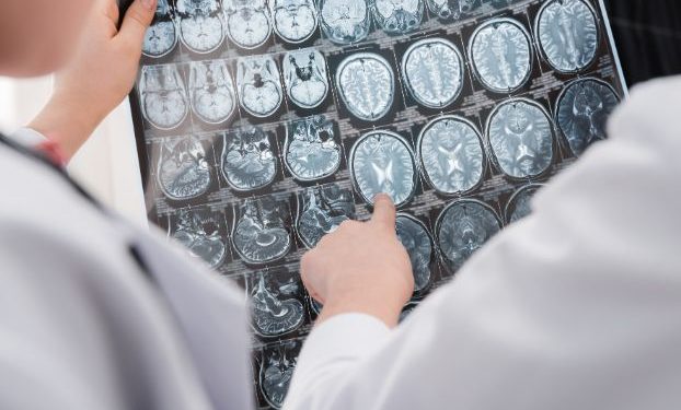 הצעד הראשון למניעת שבץ מוחי הוא תזונה בריאה – אורן זריף – אירוע מוחי – Oren Zarif